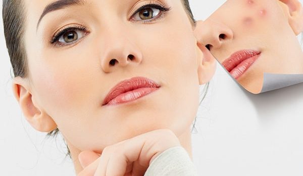 best-pimple-treatment-clinic-in-bangalore